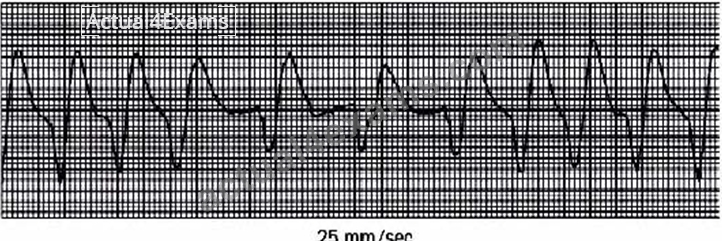 [Apr-2025] Updated Pulmonary Function Technician RPFT Exam Questions ...